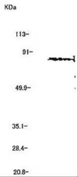 Anti-MMP-2 (Ab-3) Mouse mAb (42-5D11), 100 µG (IM33-100UG)
