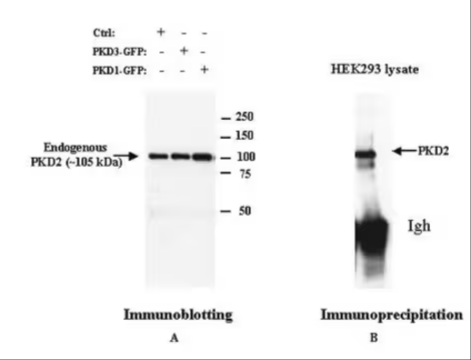 Anti-PKD2 Rabbit pAb, 50 µG (ST1042-50UG)