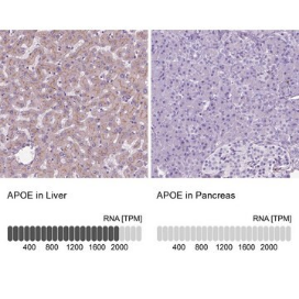 Anti-APOE antibody produced in rabbit, 100 µL (HPA065539-100UL)