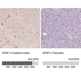 Anti-GFAP antibody produced in rabbit, 100 µL (HPA063513-100UL)