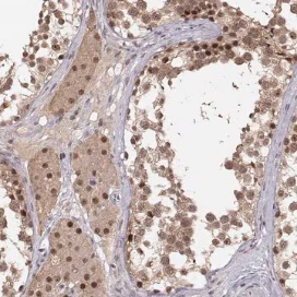 Anti-CSNK2A1 antibody produced in rabbit, 100 µL (HPA061698-100UL)