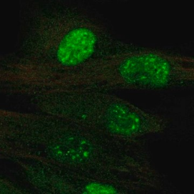Anti-TERT antibody produced in rabbit, 100 µL (HPA054641-100UL)