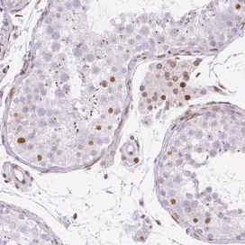 Anti-PLK1 antibody produced in rabbit, 1 X 100 µL (HPA051638-100UL)