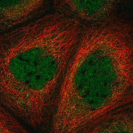 Anti-SMAD3 antibody produced in rabbit, 100 µL (HPA046386-100UL)