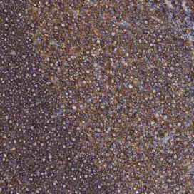 Anti-ACTB antibody produced in rabbit, 100 µL (HPA041264-100UL)