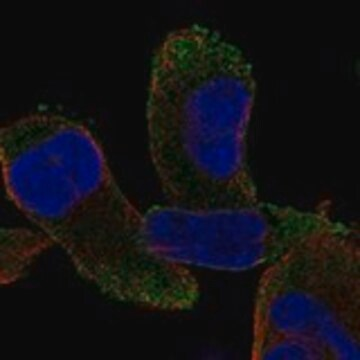 Anti-CPZ antibody produced in rabbit, 1 X 100 µL (HPA078608-100UL)
