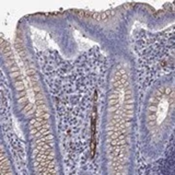 Anti-MADCAM1 antibody produced in rabbit, 1 X 100 µL (HPA077998-100UL)