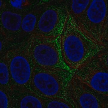 Anti-ADCY5 antibody produced in rabbit, 100 µL (HPA077682-100UL)