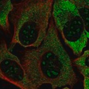 Anti-DOHH antibody produced in rabbit, 1 X 100 µL (HPA076271-100UL)