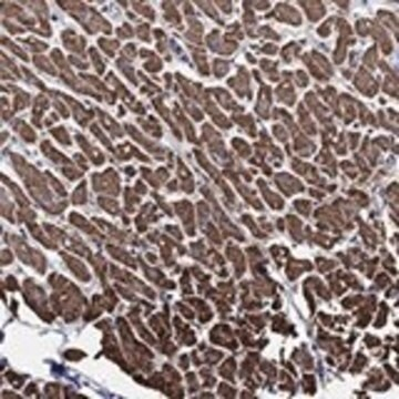 Anti-NDUFAB1 antibody produced in rabbit, 1 X 100 µL (HPA076020-100UL)