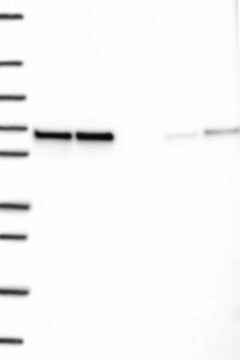 Anti-CCDC47 antibody produced in rabbit, 1 X 100 µL (HPA075958-100UL)