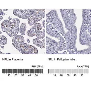 Anti-NPL antibody produced in rabbit, 1 X 100 µL (HPA075808-100UL)