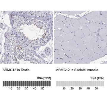 Anti-ARMC12 antibody produced in rabbit, 1 X 100 µL (HPA075777-100UL)