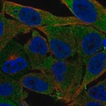 Anti-PMM1 antibody produced in rabbit, 1 X 100 µL (HPA074950-100UL)