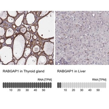 Anti-RABGAP1 antibody produced in rabbit, 100 µL (HPA072273-100UL)