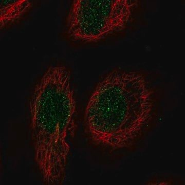 Anti-RELT antibody produced in rabbit, 100 µL (HPA071518-100UL)