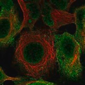 Anti-EPN1 antibody produced in rabbit, 1 X 100 µL (HPA071503-100UL)