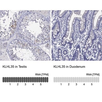 Anti-KLHL35 antibody produced in rabbit, 1 X 100 µL (HPA070736-100UL)