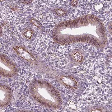 Anti-ACER3 antibody produced in rabbit, 100 µL (HPA070087-100UL)