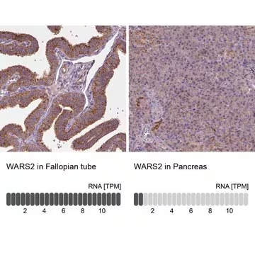 Anti-WARS2 antibody produced in rabbit, 100 µL (HPA069692-100UL)