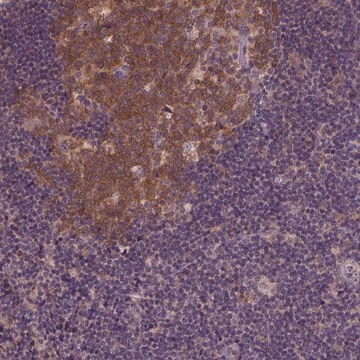 Anti-KBTBD8 antibody produced in rabbit, 100 µL (HPA069190-100UL)
