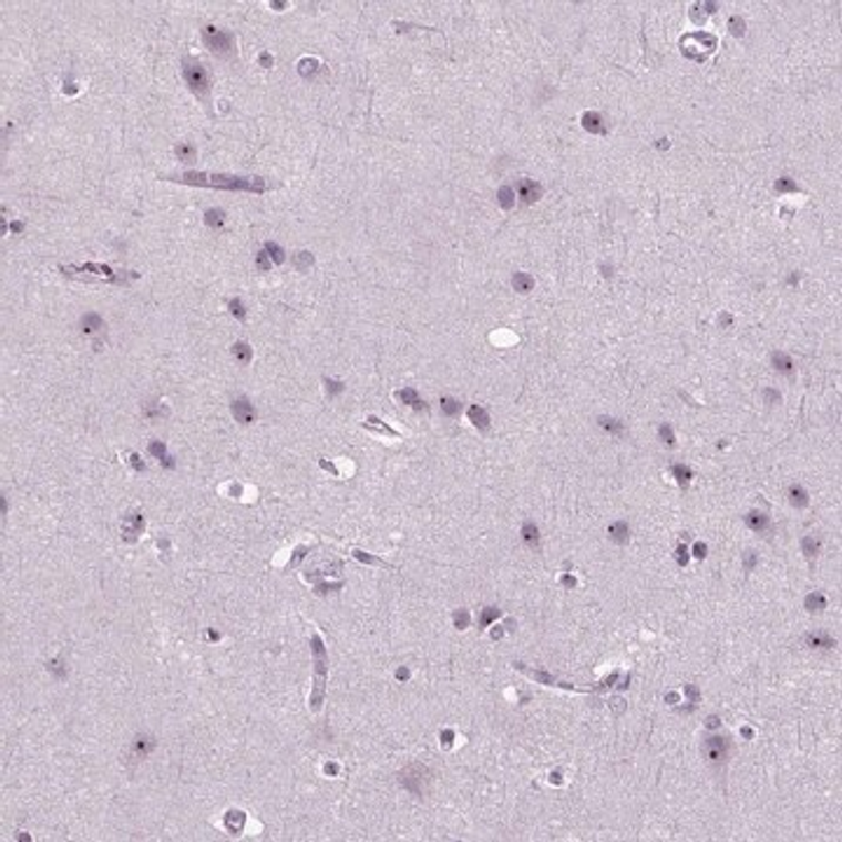 Anti-ZNF853 antibody produced in rabbit, 100 µL (HPA067690-100UL)