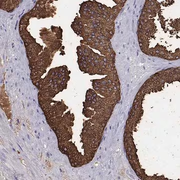 Anti-UMODL1 antibody produced in rabbit, 100 µL (HPA067245-100UL)