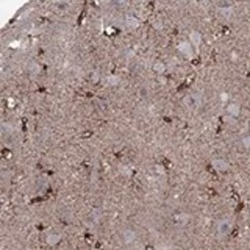 Anti-SNTA1 antibody produced in rabbit, 1 X 100 µL (HPA067154-100UL)