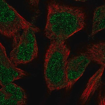 Anti-PKNOX2 antibody produced in rabbit, 100 µL (HPA066962-100UL)