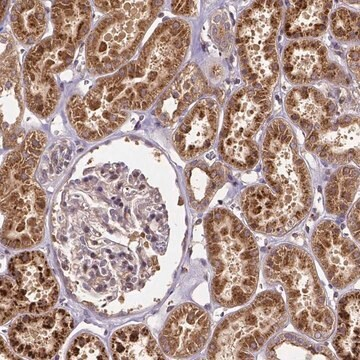 Anti-RNF123 antibody produced in rabbit, 100 µL (HPA065983-100UL)