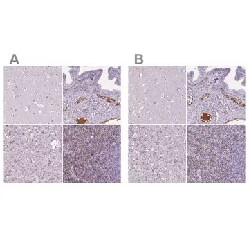 Anti-CD5L antibody produced in rabbit, 100 µL (HPA065686-100UL)