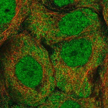 Anti-ALDH1A3 antibody produced in rabbit, 100 µL (HPA064749-100UL)