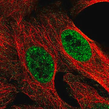 Anti-MED22 antibody produced in rabbit, 100 µL (HPA063694-100UL)