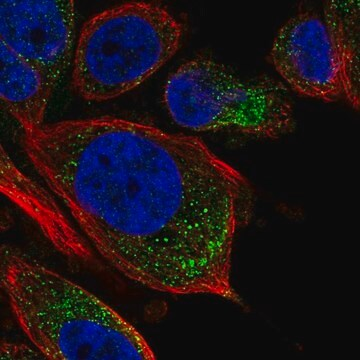 Anti-TPRG1L antibody produced in rabbit, 100 µL (HPA063163-100UL)