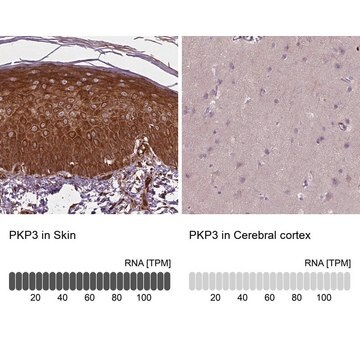 Anti-PKP3 antibody produced in rabbit, 100 µL (HPA062937-100UL)