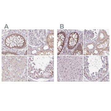 Anti-RSL24D1 antibody produced in rabbit, 100 µL (HPA062724-100UL)