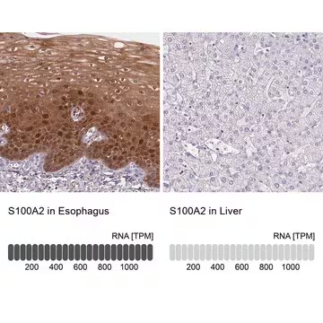 Anti-S100A2 antibody produced in rabbit, 100 µL (HPA062451-100UL)