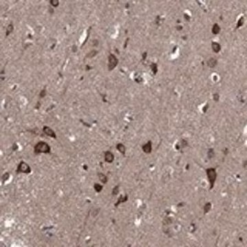 Anti-HABP4 antibody produced in rabbit, 1 X 100 µL (HPA062366-100UL)