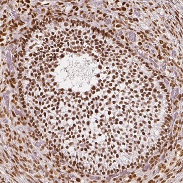 Anti-NUCKS1 antibody produced in rabbit, 100 µL (HPA062351-100UL)