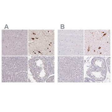 Anti-PMCH antibody produced in rabbit, 100 µL (HPA061884-100UL)