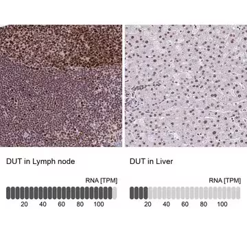 Anti-DUT antibody produced in rabbit, 100 µL (HPA060360-100UL)