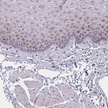 Anti-ZNF554 antibody produced in rabbit, 1 X 100 µL (HPA060247-100UL)
