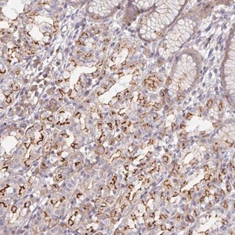 Anti-DISP2 antibody produced in rabbit, 1 X 100 µL (HPA059903-100UL)