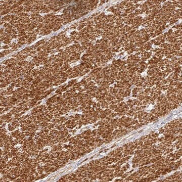 Anti-METTL22 antibody produced in rabbit, 100 µL (HPA059882-100UL)