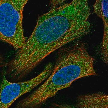 Anti-C14orf28 antibody produced in rabbit, 100 µL (HPA059635-100UL)