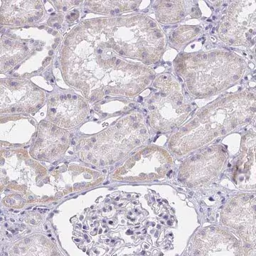 Anti-ZNF182 antibody produced in rabbit, 1 X 100 µL (HPA059574-100UL)