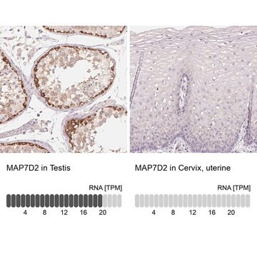 Anti-MAP7D2 antibody produced in rabbit, 100 µL (HPA059537-100UL)