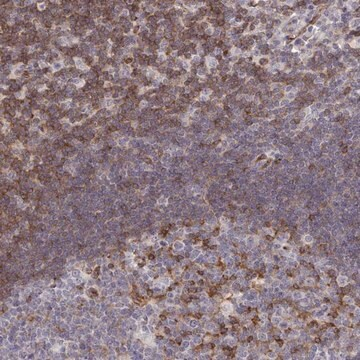 Anti-FOXN3 antibody produced in rabbit, 100 µL (HPA059209-100UL)