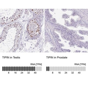 Anti-TIPIN antibody produced in rabbit, 100 µL (HPA058799-100UL)