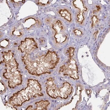 Anti-ANKRD33 antibody produced in rabbit, 1 X 100 µL (HPA058753-100UL)